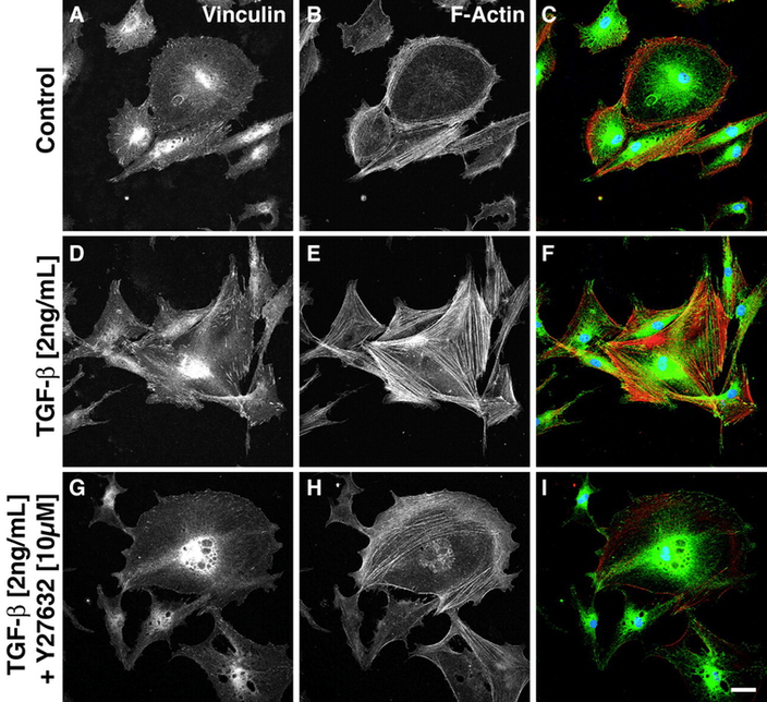 Figure 9. Fibroblasts were stimulated with vehicle (A-C), TGF-β alone (D-F), or TGF-β with Y-27632 